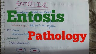 Entosis Pathology [upl. by Hannahc853]