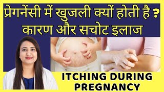 प्रेगनेंसी में खुजली क्यों होती है  ITCHING DURING PREGNANCY [upl. by Anabel]