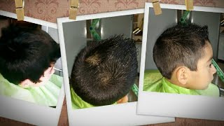 Corte para hombres con cabello con remolinos y gallito👨 [upl. by Noside]