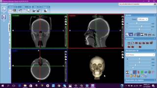 Instalación Software Planmeca Romexis desde Dicom [upl. by Ranite]