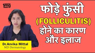 फोड़े फुंसी का इलाज कैसे करे Dr Anvika Mittal [upl. by Laszlo534]