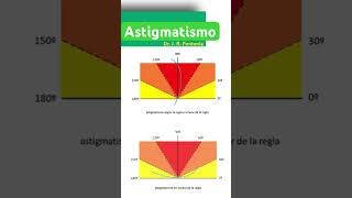 Astigmatismo a Favor o en Contra de la Regla [upl. by Ivanna]