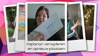 Implanon verwijderen en opnieuw laten plaatsen  vlog  66  de Maffe Mama [upl. by Dragone]