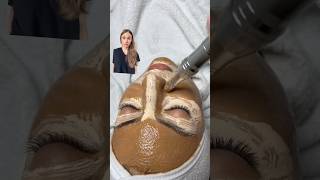 Watch Out BB Glow Facial Could Be Your Beauty Nightmare [upl. by Seed884]