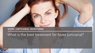 What is the best treatment for hives urticaria [upl. by Niko979]