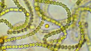 Nostoc commune  the nitrogen fixing cyanobacterium [upl. by Adelina]