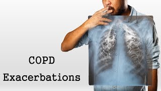 COPD Exacerbations [upl. by Margarete]