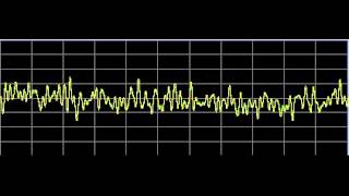 Metabolism Repair  Rife Frequencies [upl. by Diskin716]