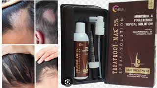 TREATROOT MAX 5 SPRAY SOLUTION MINOXIDIL amp FINASTERIDE TOPICAL SOLUTION [upl. by Aigneis]