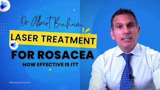 Laser Treatment For Rosacea How Effective Is It [upl. by Hyrup359]