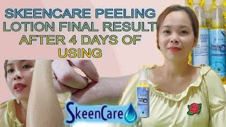 SKEENCARE PEELING LOTION PRODUCT DEMO PART III FINAL RESULT AFTER 4 DAYS OF USING [upl. by Lamphere]