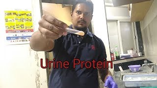 Urine Protein Test Procedure [upl. by Joby]