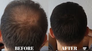 Hair Fiber Results  Is Hair Fiber Waterproof [upl. by Neevan303]