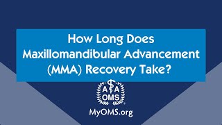 How Long Does Maxillomandibular Advancement MMA Recovery Take [upl. by Kirrad]