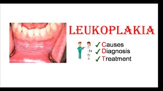 Leukoplakia  Causes Diagnosis amp Treatment [upl. by Barbaraanne]