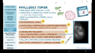 Benign breast conditions  pathology review  Osmosis [upl. by Nnomae]