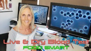 Live amp Dry Blood Test  What to expect  My Life Blood  Maria Waldock [upl. by Almeida]