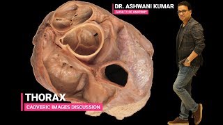 THORAX Cadaveric images discussion [upl. by Osrock550]