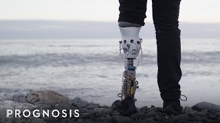 This MIT Engineer Built His Own Bionic Leg [upl. by Lesig6]