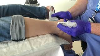 Injection  posterior heel USS guided highvolume injections [upl. by Martyn]