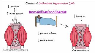 Orthostatic Hypotension Described Concisely [upl. by Burford]