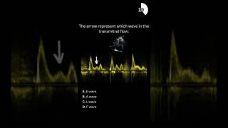 Echocardiography board practice question 27 [upl. by Octave]