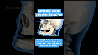 How Tooth Extraction Affects Your Jaw and Face [upl. by Clintock960]