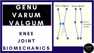 Tibiofemoral Alignment Knee joint biomechanics physiotherapy tutorials [upl. by Ranitta]