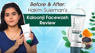 Hakim Suleman Kalonji Facewash Review Is Kalonji Good For Skin Kalonji Benefits [upl. by Stelle]