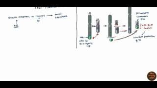 Acute Myelogenous Leukemia AML amp Chronic Myelogenous Leukemia CMLfor USMLE [upl. by Hajidahk734]