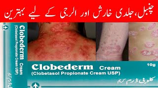 Clobederm cream uses in urdu  Clobetasol  Benefits  How to apply  Side effects  cream [upl. by Drusus]