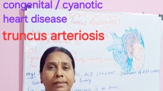 congenital cyanotic heart disease truncus arteriosis class in tamil [upl. by Armanda823]