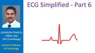 ECG Simplified  Part 6 [upl. by Pelagi608]