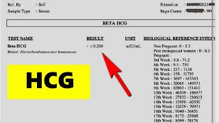 INTERPRET YOUR HCG RESULT LEARN IN 4 MINUTES [upl. by Cecilius]