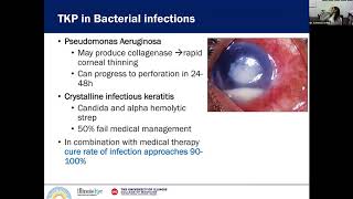 Penetrating Keratoplasty in Infectious Keratitis [upl. by Ahsyt]