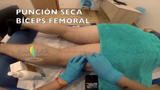 Punción Seca Bíceps Femoral [upl. by Eirrac13]