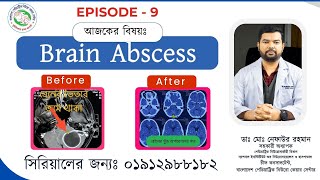 Before After Episode 09 Brain Abscess Surgery By Best Paediatric Neurosurgeon Nafaur in Bangladesh [upl. by Nebra]