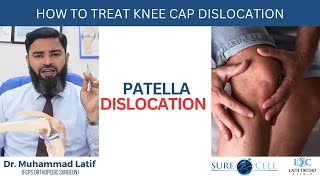 How to treat knee cap dislocation Patella Dislocation  Dr Latif [upl. by Repinuj]