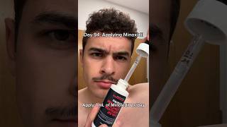 Minoxidil for MAX Beard Growth [upl. by Yllod260]