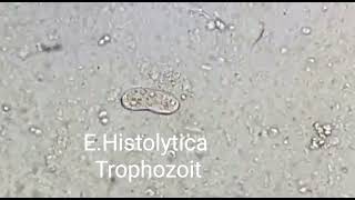 Trophozoite of Entamoeba histolytica [upl. by Dlonyar251]