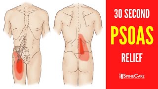 How to Fix a Tight Psoas Muscle in 30 SECONDS [upl. by Tris384]