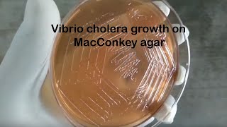 Vibrio cholerae colonies characteristics on Macconkey medium [upl. by Viquelia]