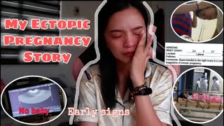 My Ectopic Pregnancy Story  My Angel [upl. by Van]