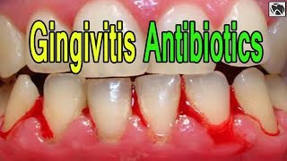 Gingivitis Antibiotics  What is the Best ANTIBIOTIC for Gingivitis [upl. by Nuaj127]