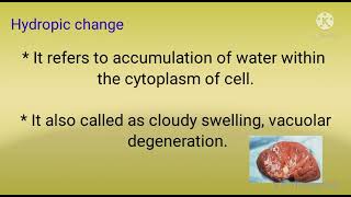 Hydropic change pathology  morphology of reversible cell injury part1 [upl. by Sellers]