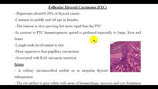 Follicular Thyroid Carcinoma FTC [upl. by Orbadiah]