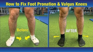 VERY EFFECTIVE Way to FIX Pronated feet amp Knees Caving In Valgus Knees [upl. by Aredna]