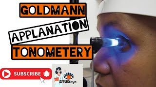 Goldmann Applanation Tonometer  Tonometry [upl. by Stav]