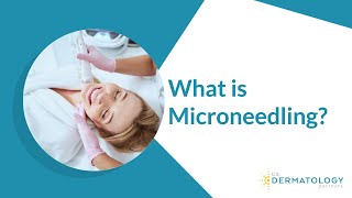 What is Microneedling  Microneedling Treatment [upl. by Aruabea]