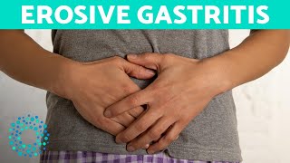 EROSIVE GASTRITIS  Belly Pain And Vomiting [upl. by Helsie]